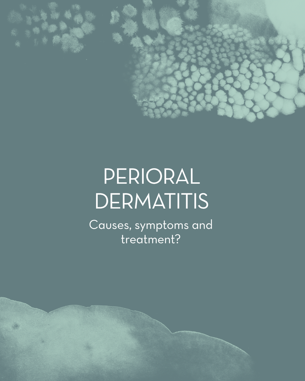 Perioral Dermatitis POD: Causes, symptoms and treatment