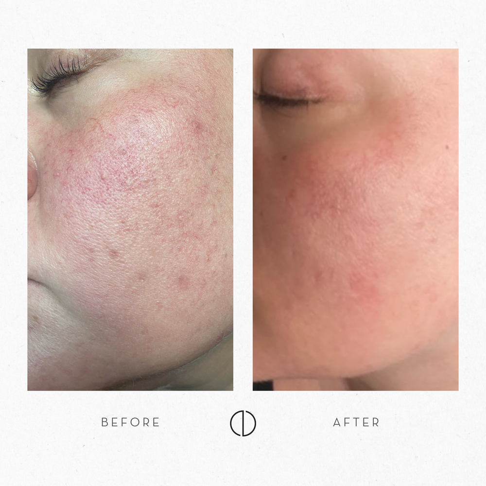 Before and after image