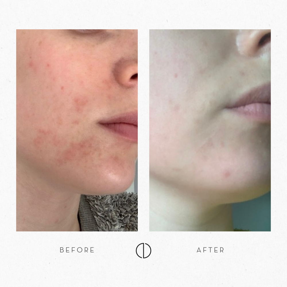 Viivi: Reactive skin