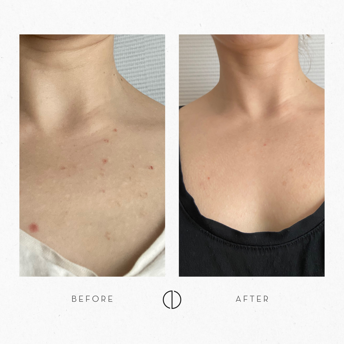 Anu & Dry, congested & reactive skin