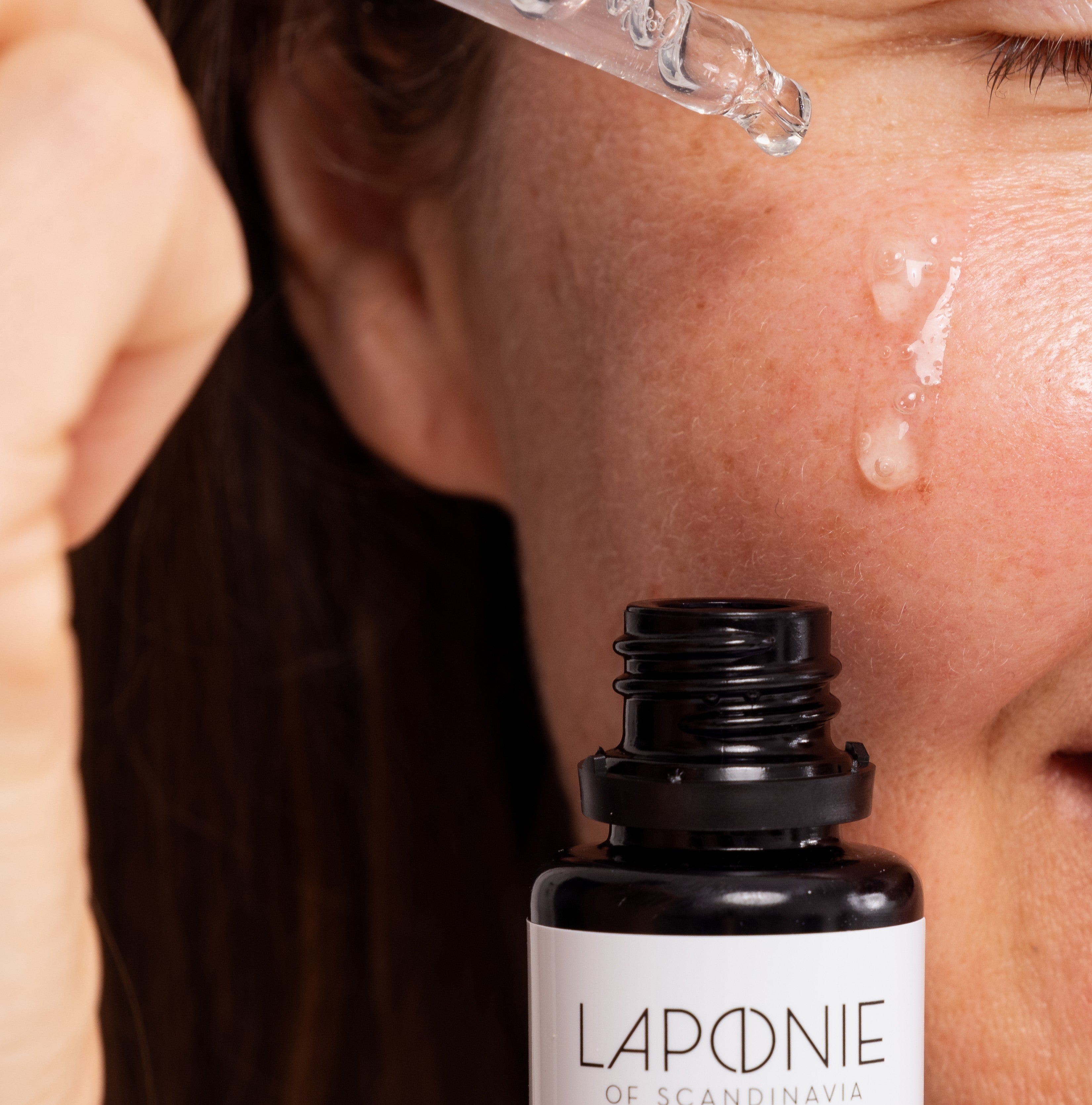 Couperose Skin