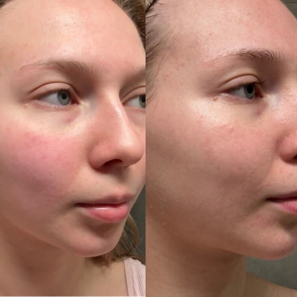 Cleansing & Balancing Face Mask